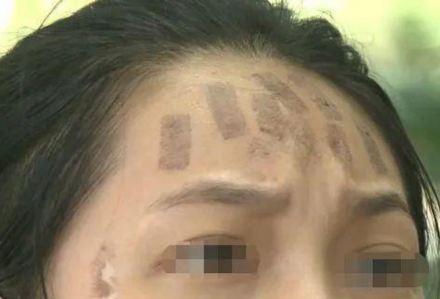 成都光子嫩膚價格，科技重塑肌膚之美