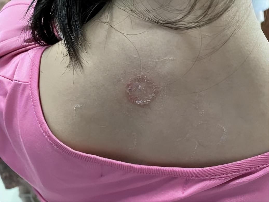 尤卓爾軟膏價格大解密，重磅揭秘真實價格??