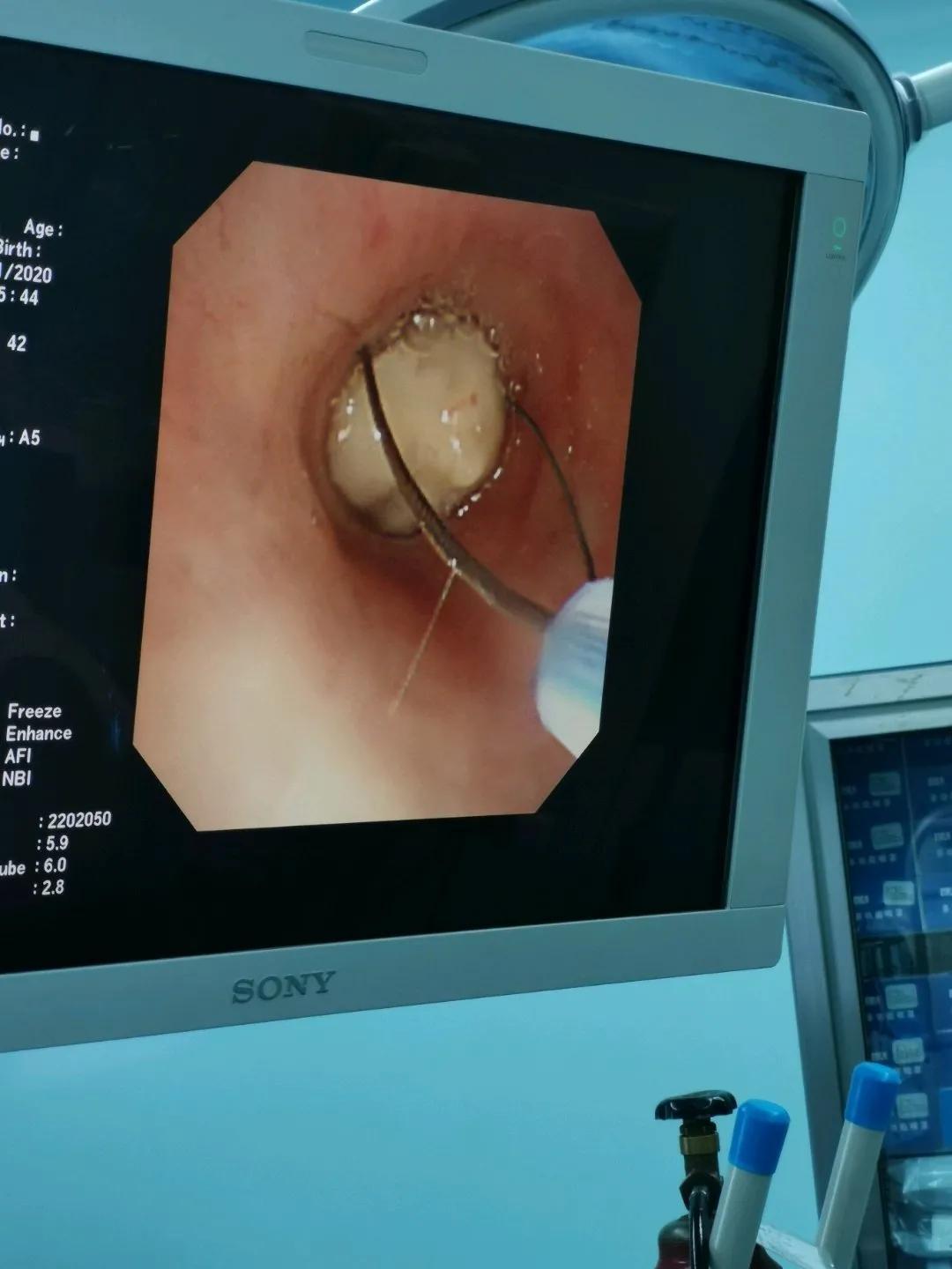 電子鼻咽喉鏡價(jià)格的市場(chǎng)定位分析，多元因素下的市場(chǎng)趨勢(shì)探討