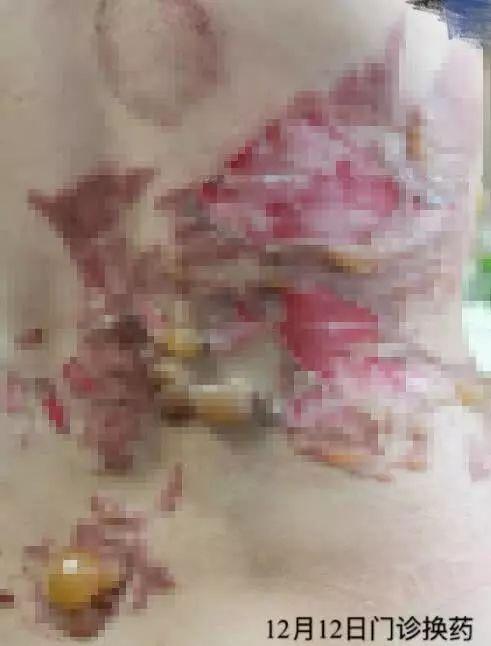 小巷特色養(yǎng)生館，最新拔罐圖片分享