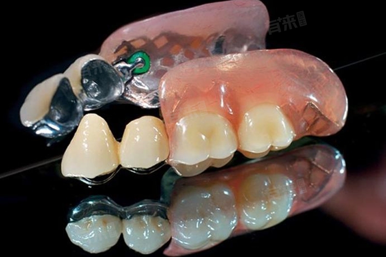 關(guān)于活動(dòng)假牙價(jià)格的探討與解析