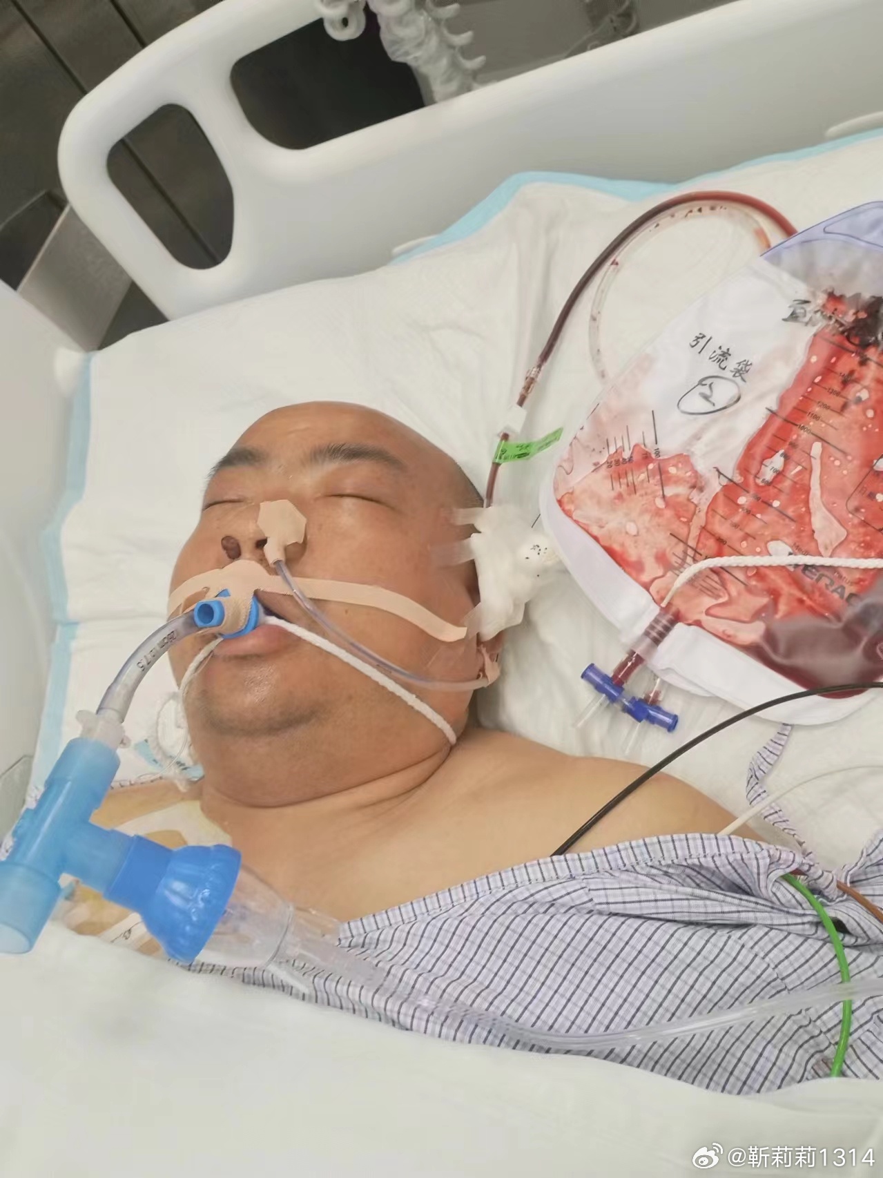 馮現(xiàn)學腦出血最新消息及應(yīng)對幫助指南(初學者與進階用戶參考)