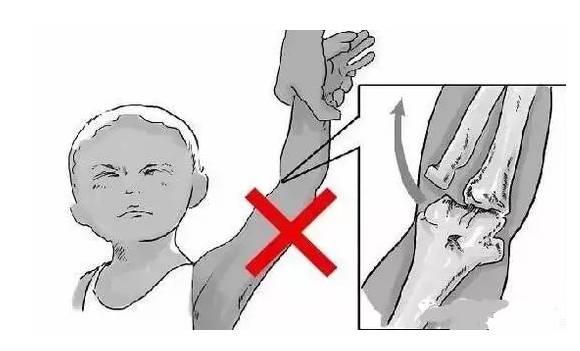 軟骨發(fā)育不全最新治療及步驟指南解析